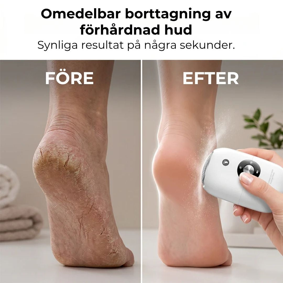 SilkesFot – Salongsmjuka fötter på sekunder