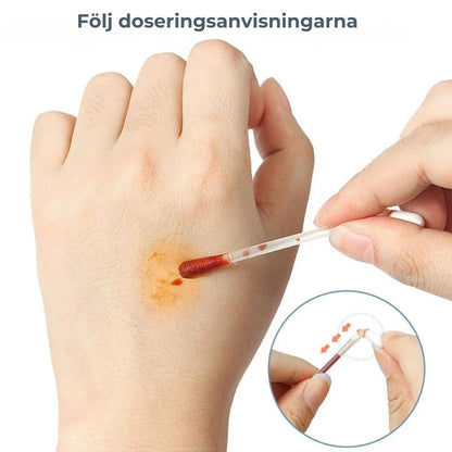 SnapCare – Direkt och hygienisk sårvård på sekunder (50 stycken)