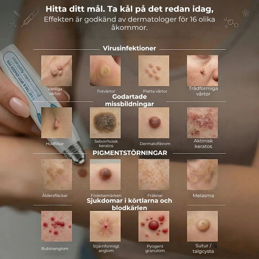 SlätHud – Smärtfri borttagning på 7 dagar