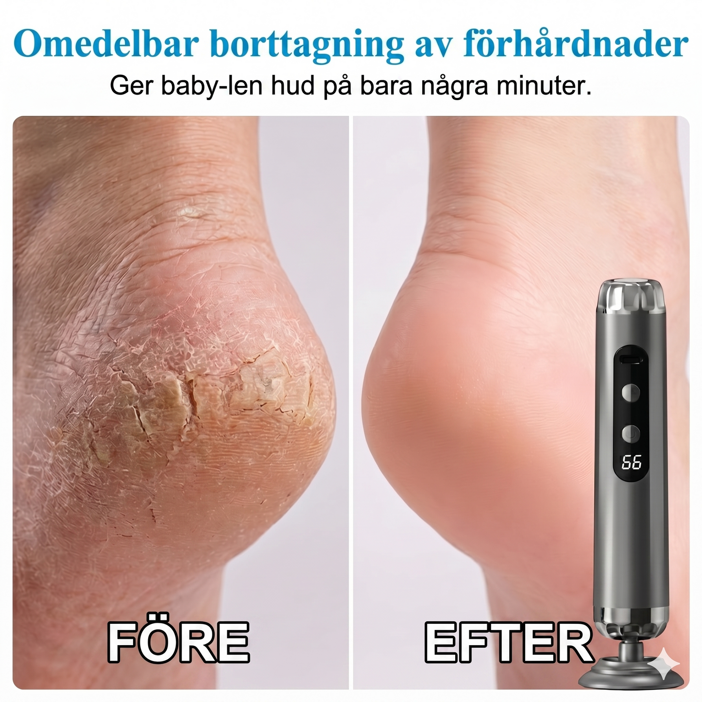 TurboFil – Fem hastigheter för mjuka fötter