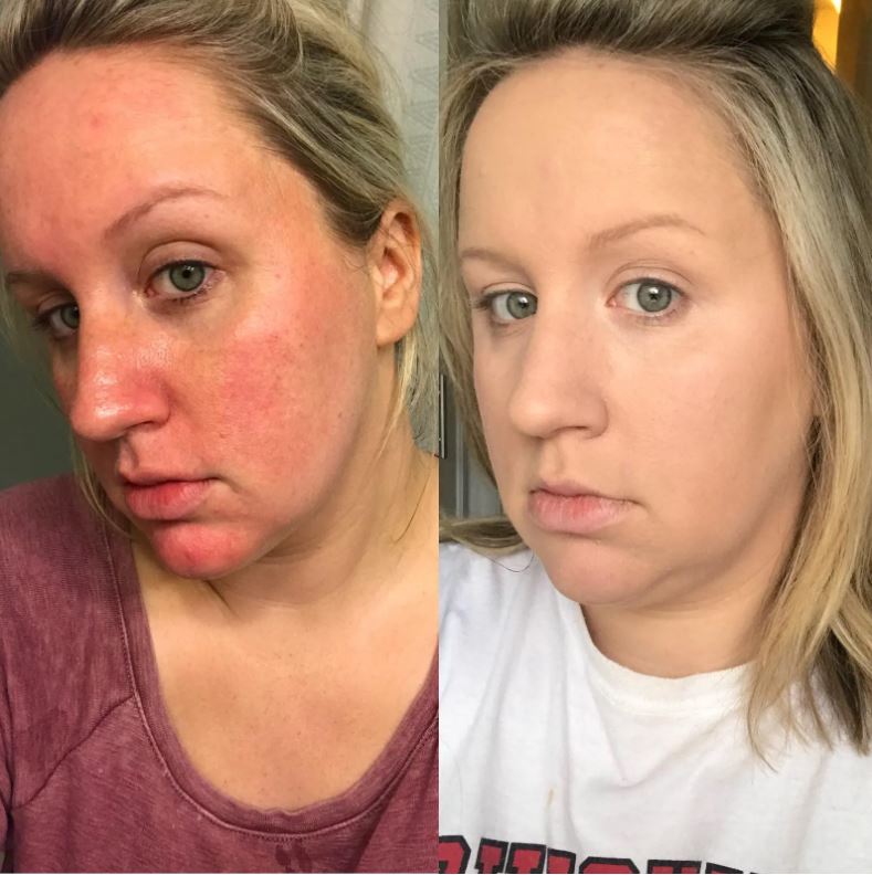 BrowPerfect™ – Smärtfri precision för felfria ögonbryn